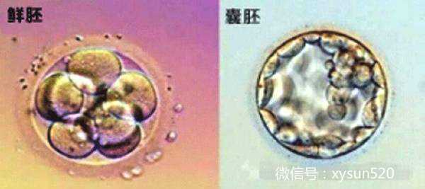 广州有做代孕的公司吗,要不要养囊？广州试管囊胚移植的5个理由-上海供卵试管