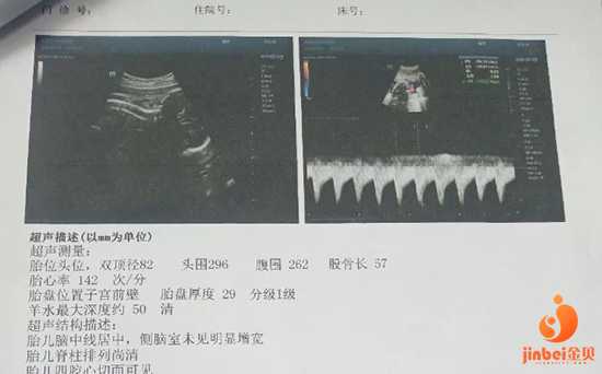 鹤岗代孕的中心有哪些_鹤岗正规代孕医院多少钱_不想接触广州地下供卵机构，