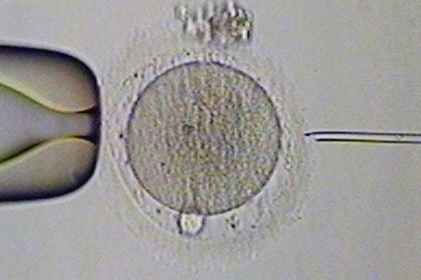 西藏代孕生殖专家_台湾试管婴儿胚胎基因检测的好处