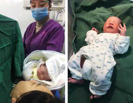 福州代孕两年包成功价格_宜昌市试管婴儿多少钱？